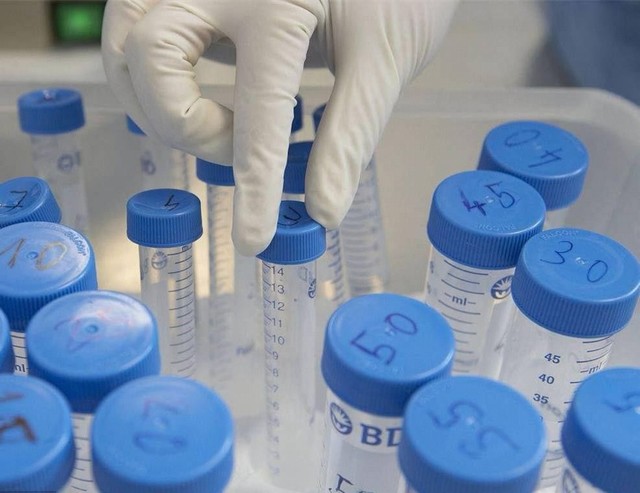 关于胚胎染色体筛查技术的一些认知